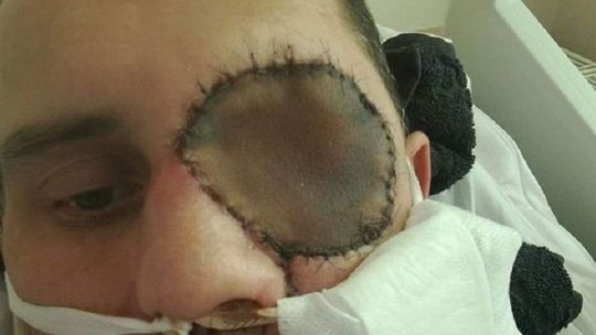 Ciężko chory Przemek walczy o życie. Ty również możesz mu pomóc