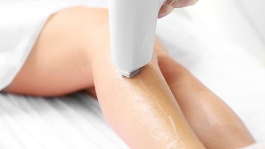 Depilacja laserowa bez tajemnic – o czym powinnaś wiedzieć