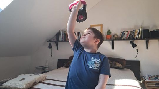 Dystrofia mięśniowa Duchenne’a (DMD): realne wyzwania  i nadzieja na lepsze dłuższe jutro.