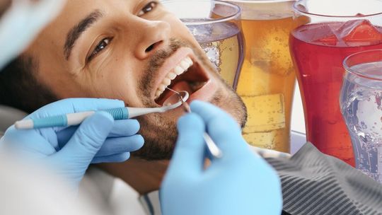 Dzisiejsi 30-latkowie stracą szybciej zęby niż ich rodzice. Winne popularne „zdrowe” napoje Dzisiejsi 30-latkowie stracą szybciej zęby niż ich rodzice. Winne popularne „zdrowe” napoje